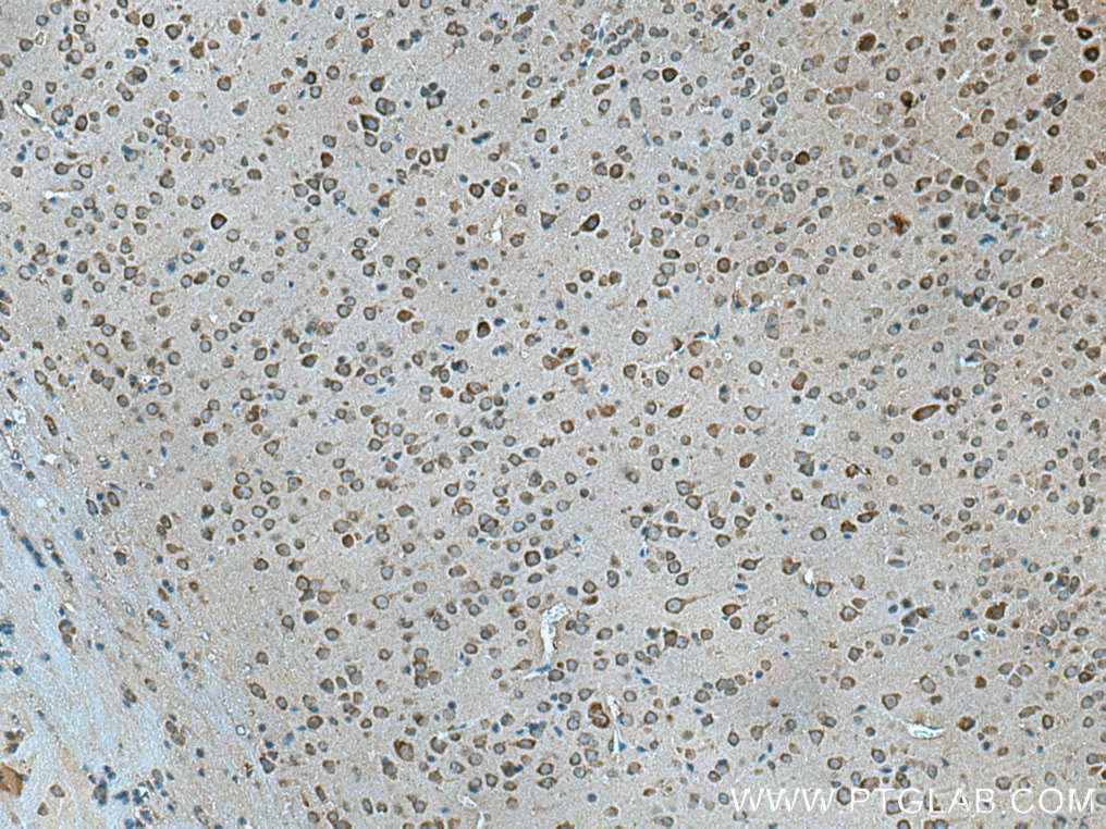 Immunohistochemistry (IHC) staining of mouse brain tissue using PGAM2 Polyclonal antibody (15550-1-AP)