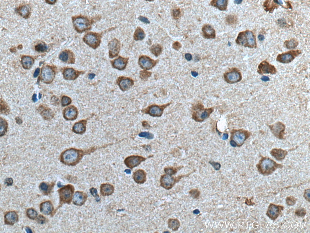 Immunohistochemistry (IHC) staining of mouse brain tissue using PGAM2 Polyclonal antibody (15550-1-AP)
