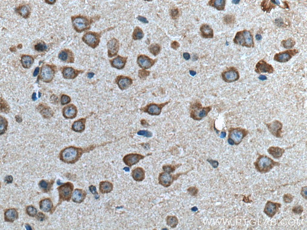 IHC staining of mouse brain using 15550-1-AP