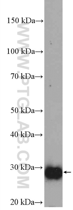 Western Blot (WB) analysis of mouse skeletal muscle tissue using PGAM2 Polyclonal antibody (15550-1-AP)