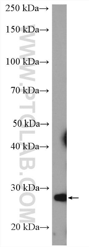 Western Blot (WB) analysis of HeLa cells using PGAM2 Polyclonal antibody (15550-1-AP)
