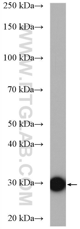 Western Blot (WB) analysis of mouse skeletal muscle tissue using PGAM2 Polyclonal antibody (15550-1-AP)