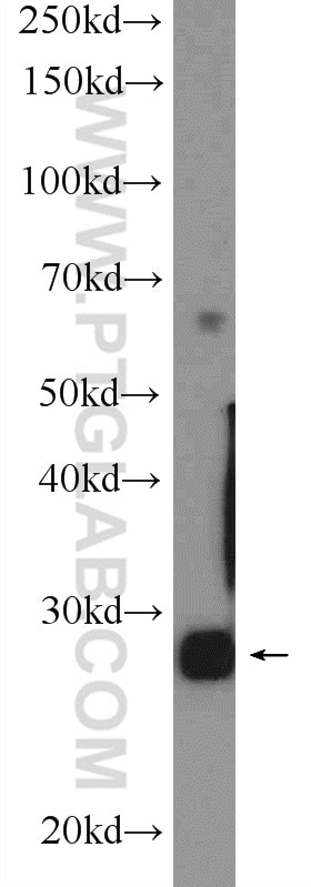 Western Blot (WB) analysis of mouse testis tissue using PGAM2 Polyclonal antibody (25518-1-AP)