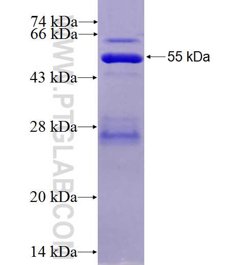 PGAM2 fusion protein Ag7908 SDS-PAGE
