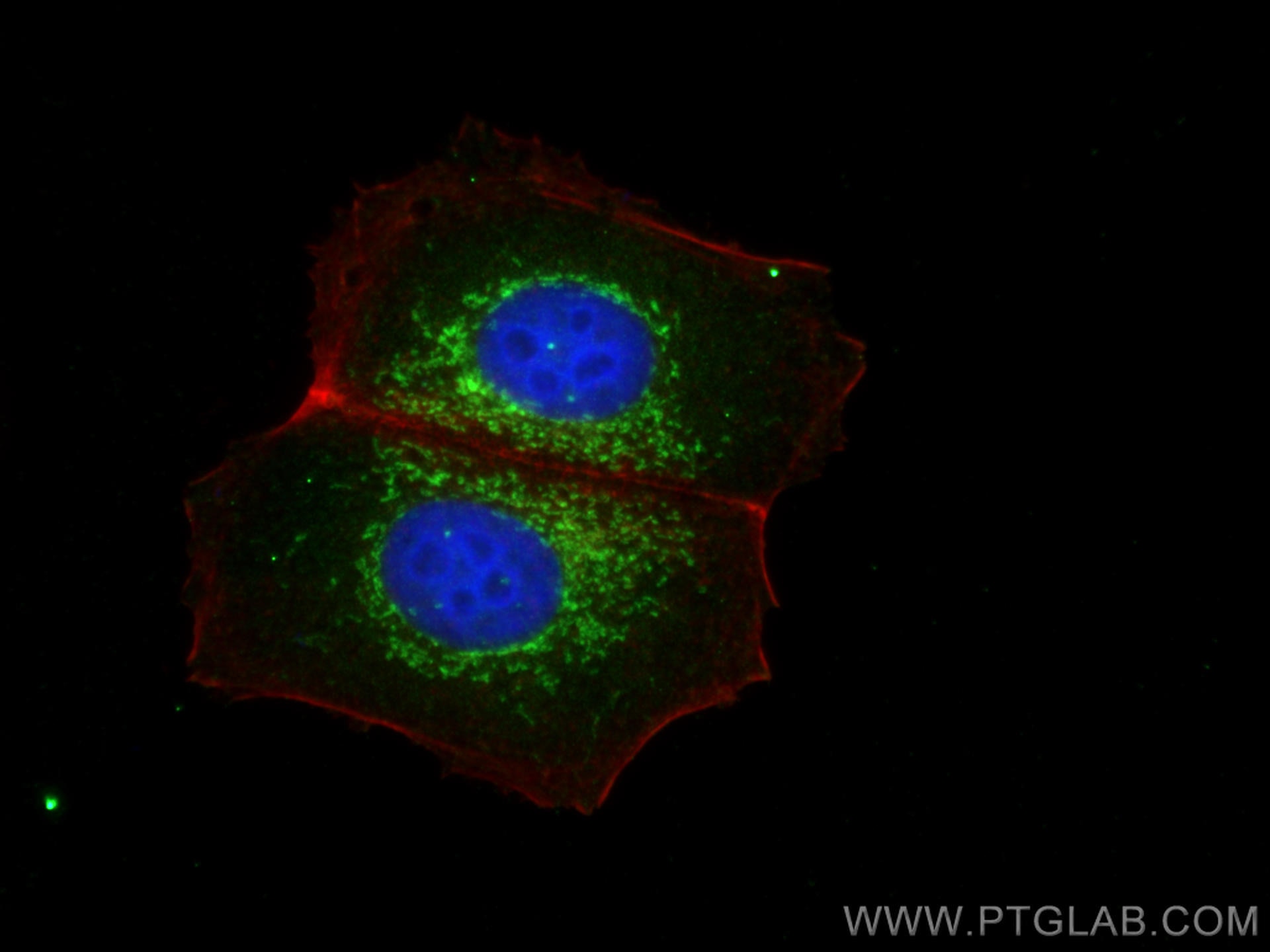 IF Staining of MCF-7 using 28445-1-AP