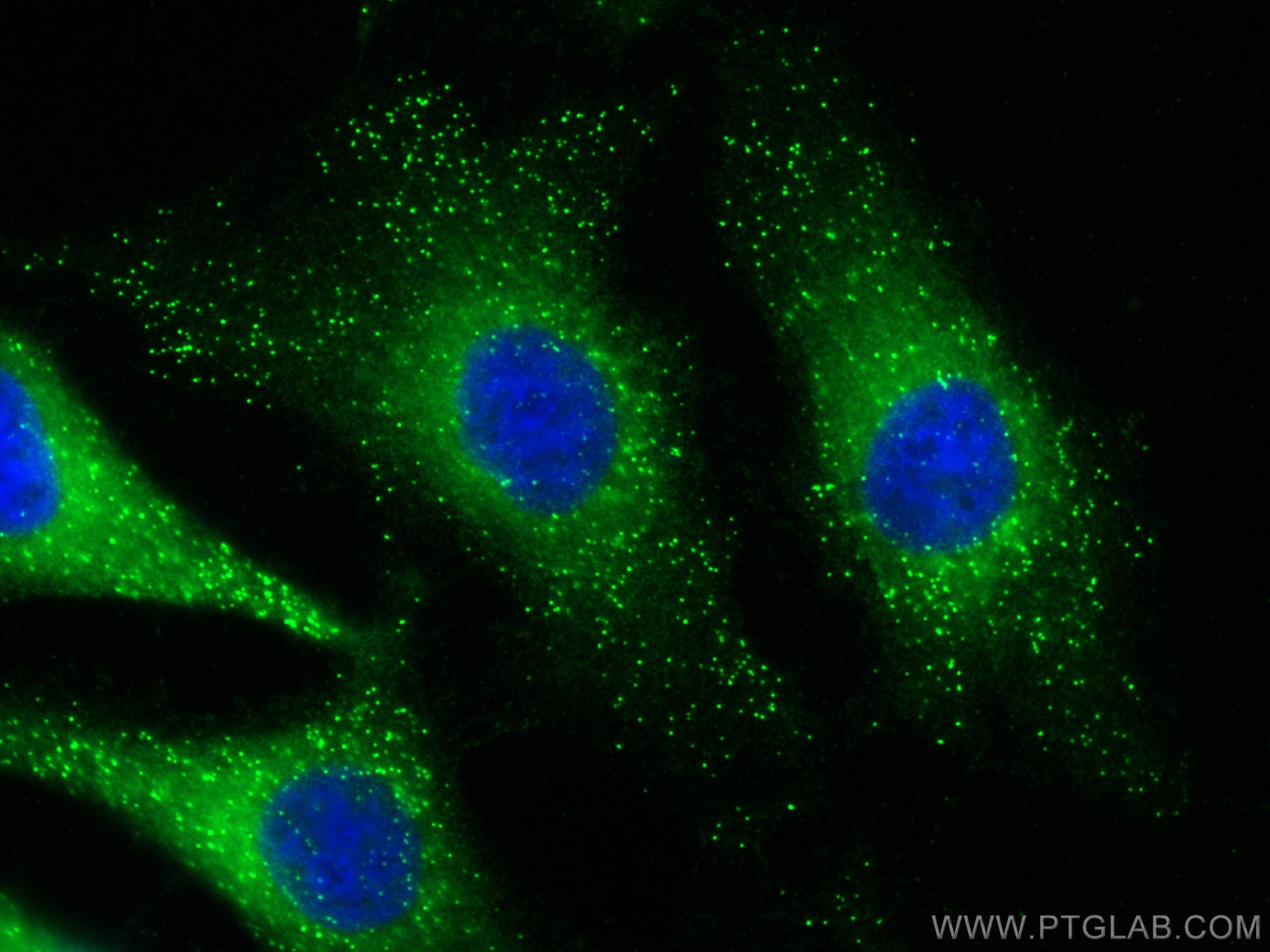 Immunofluorescence (IF) / fluorescent staining of HeLa cells using PGAP1 Polyclonal antibody (55392-1-AP)
