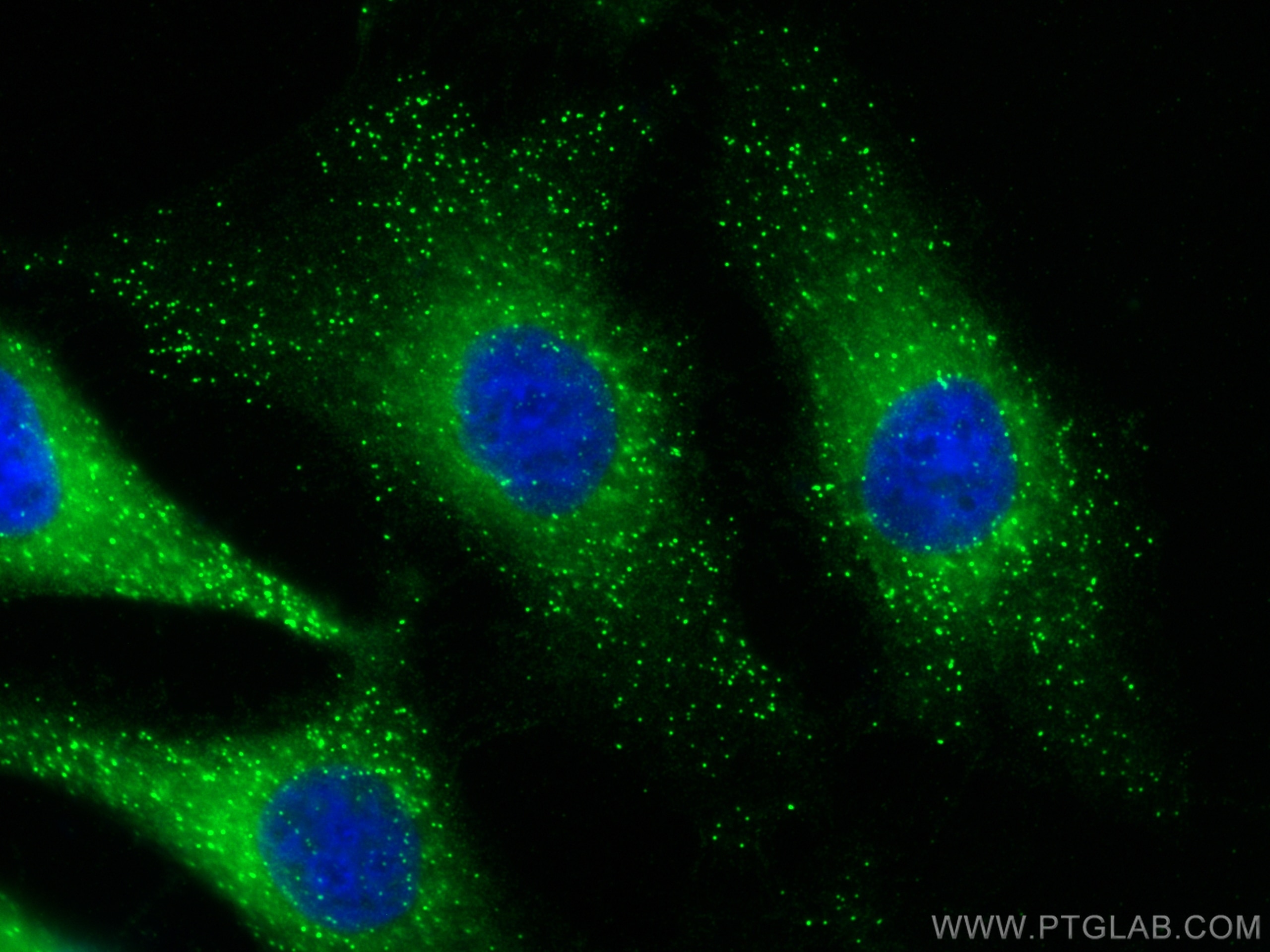 IF Staining of HeLa using 55392-1-AP