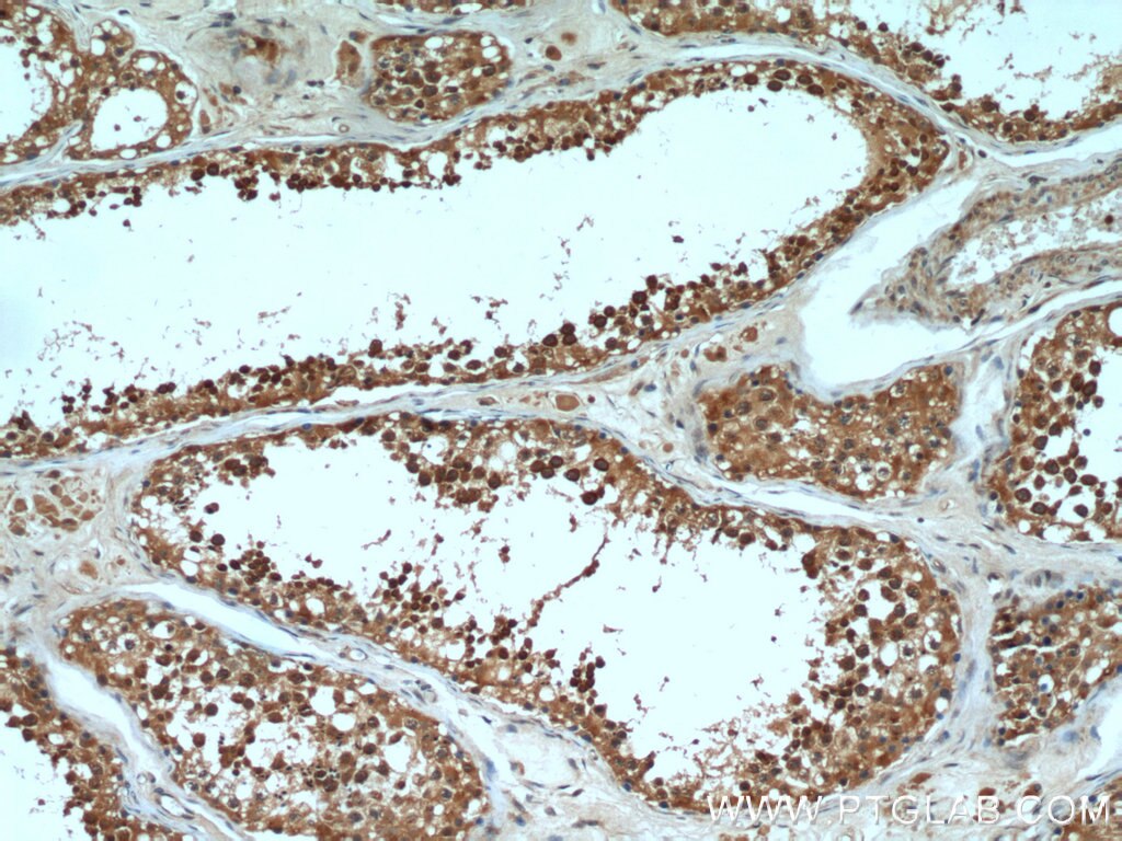 IHC staining of human testis using 55392-1-AP