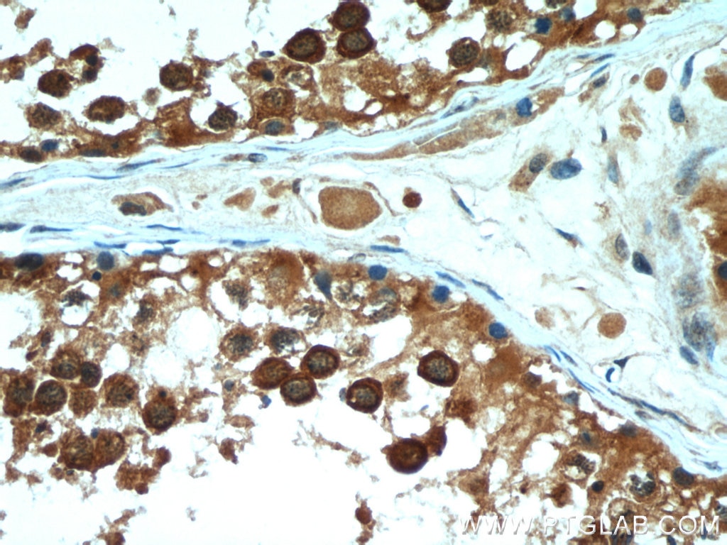 Immunohistochemistry (IHC) staining of human testis tissue using PGAP1 Polyclonal antibody (55392-1-AP)