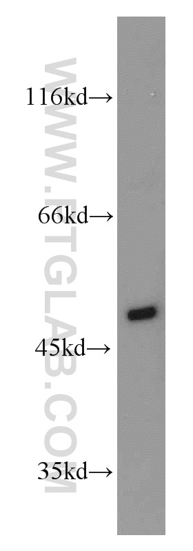 Western Blot (WB) analysis of mouse testis tissue using PGAP1 Polyclonal antibody (55392-1-AP)