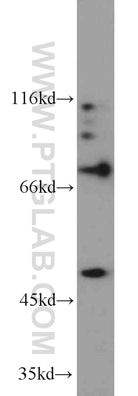 Western Blot (WB) analysis of mouse testis tissue using PGAP1 Polyclonal antibody (55392-1-AP)