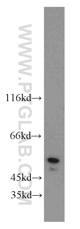 Western Blot (WB) analysis of MCF-7 cells using PGAP1 Polyclonal antibody (55392-1-AP)