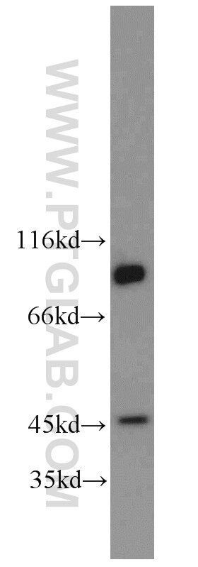 Western Blot (WB) analysis of human testis tissue using PGAP1 Polyclonal antibody (55392-1-AP)