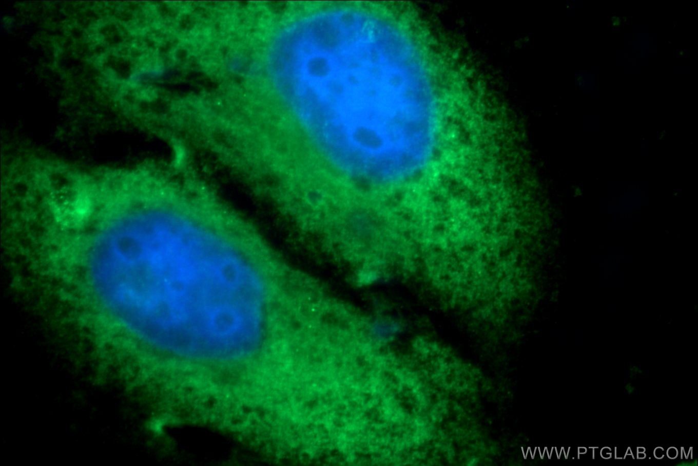 Immunofluorescence (IF) / fluorescent staining of HepG2 cells using PGBD1 Polyclonal antibody (25539-1-AP)