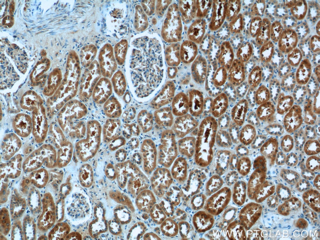 Immunohistochemistry (IHC) staining of human kidney tissue using PGBD1 Polyclonal antibody (25539-1-AP)