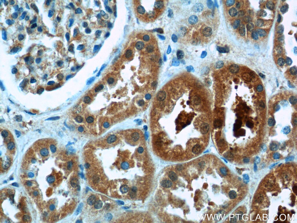Immunohistochemistry (IHC) staining of human kidney tissue using PGBD1 Polyclonal antibody (25539-1-AP)