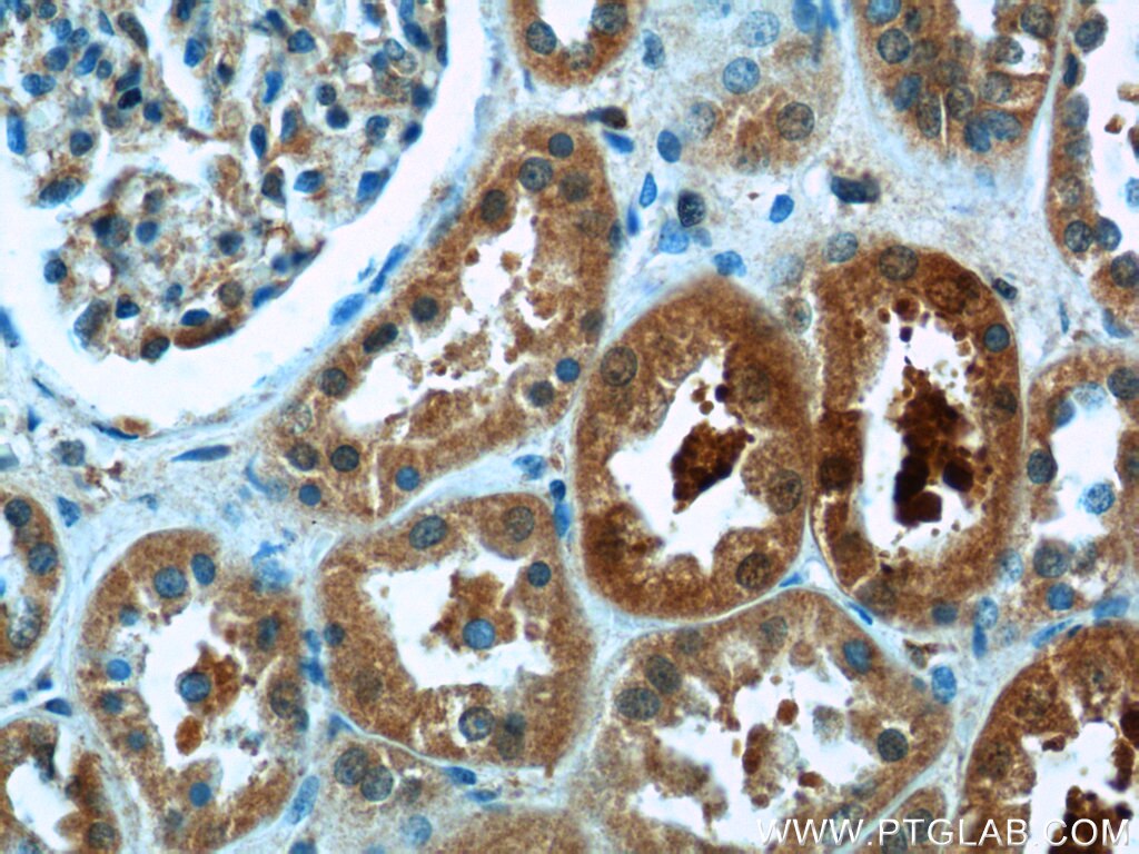 IHC staining of human kidney using 25539-1-AP