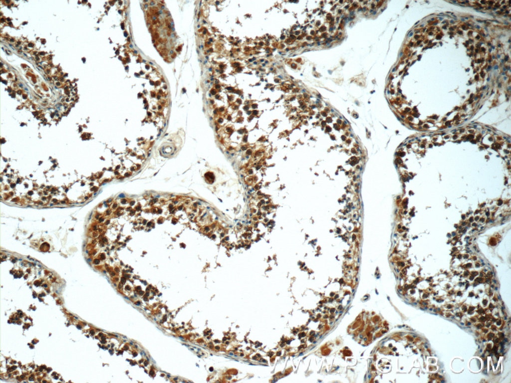 Immunohistochemistry (IHC) staining of human testis tissue using PGBD1 Polyclonal antibody (25539-1-AP)