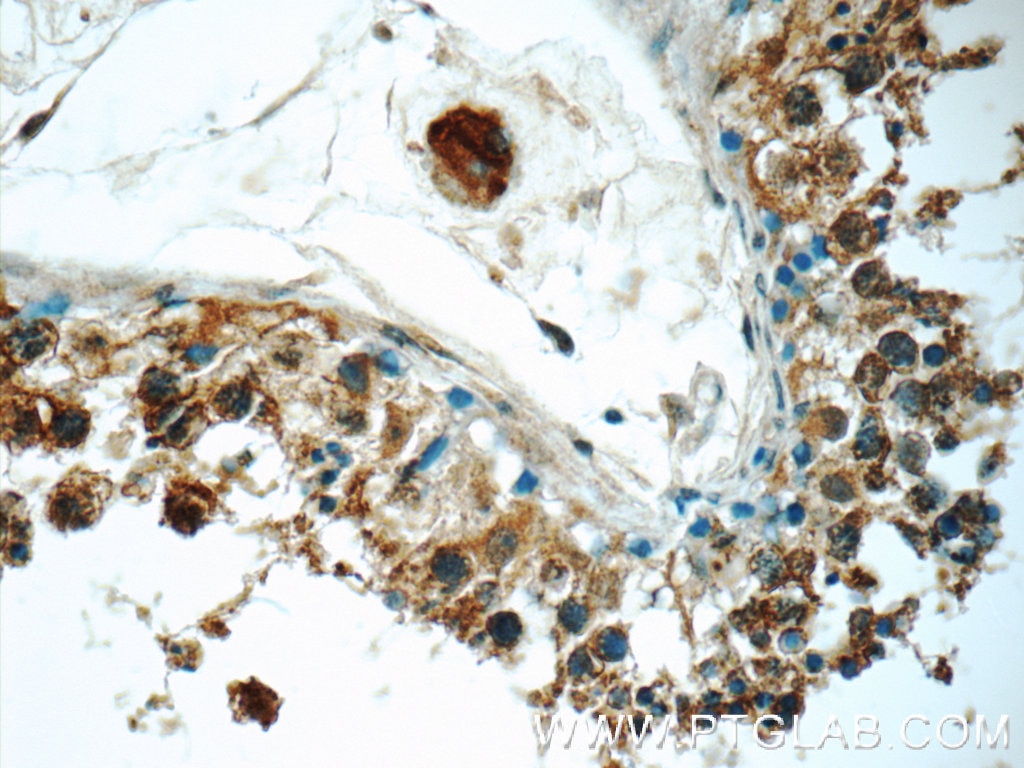 Immunohistochemistry (IHC) staining of human testis tissue using PGBD1 Polyclonal antibody (25539-1-AP)