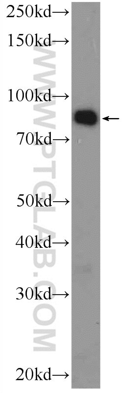 WB analysis of mouse liver using 25539-1-AP