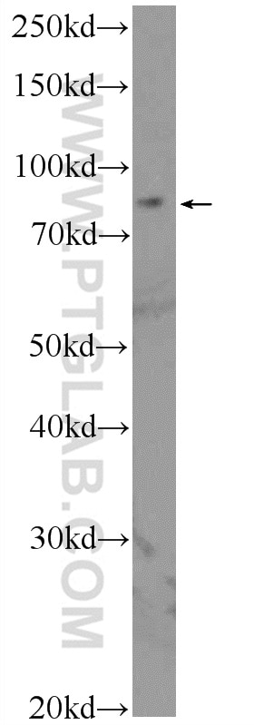 Western Blot (WB) analysis of HepG2 cells using PGBD1 Polyclonal antibody (25539-1-AP)