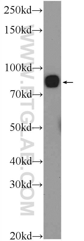 Western Blot (WB) analysis of HeLa cells using PGBD1 Polyclonal antibody (25539-1-AP)