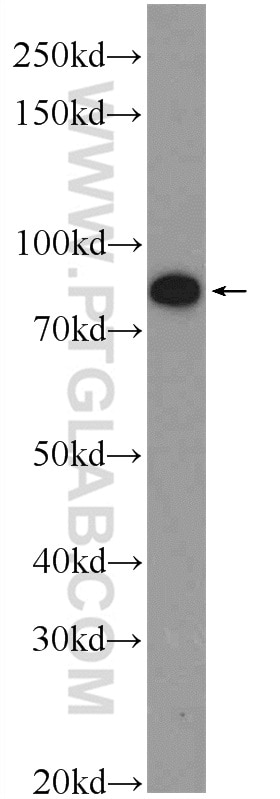 Western Blot (WB) analysis of K-562 cells using PGBD1 Polyclonal antibody (25539-1-AP)