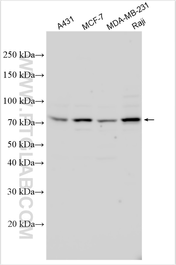 WB analysis using 32839-1-AP Western Blot (WB) analysis of various lysates using PGBD2 Polyclonal antibody (32839-1-AP)