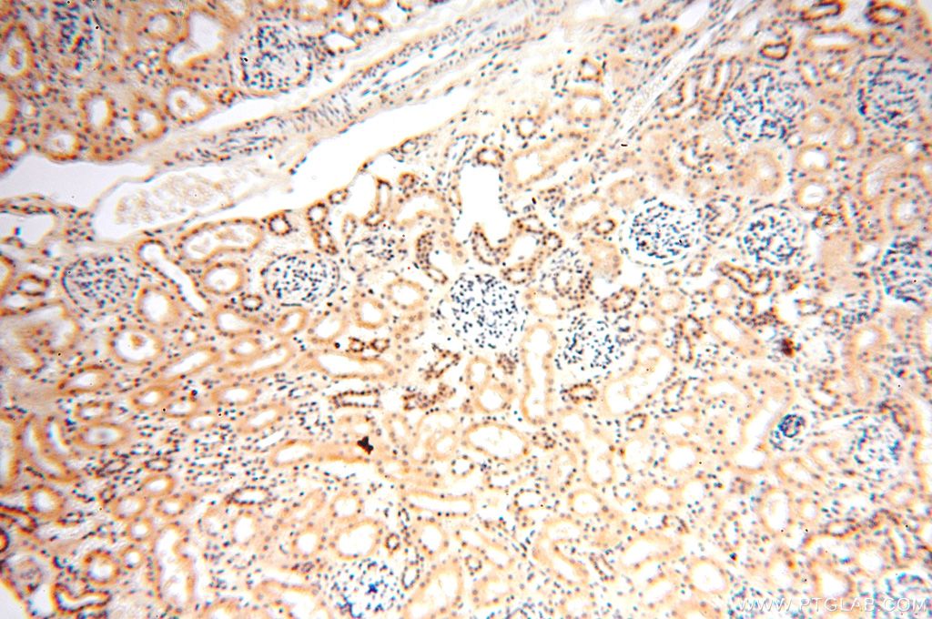 Immunohistochemistry (IHC) staining of human kidney tissue using PGBD3 Polyclonal antibody (17639-1-AP)