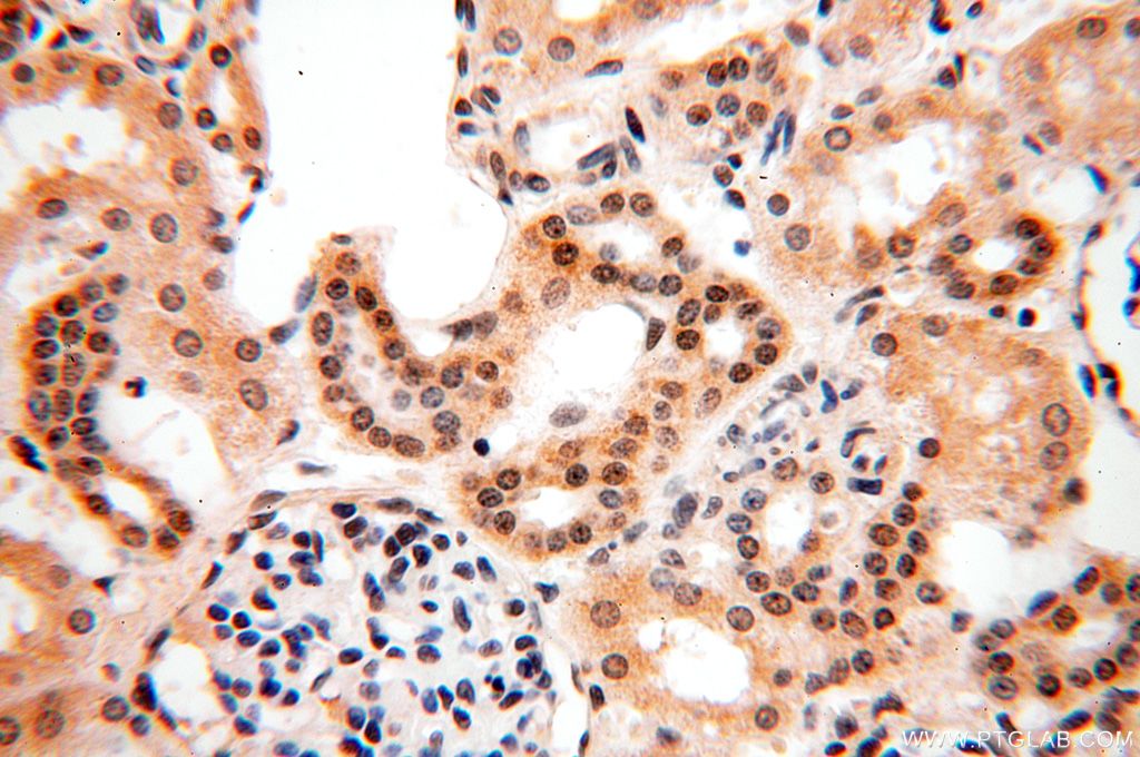 Immunohistochemistry (IHC) staining of human kidney tissue using PGBD3 Polyclonal antibody (17639-1-AP)