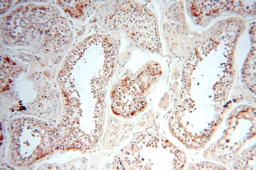 Immunohistochemistry (IHC) staining of human testis tissue using PGBD3 Polyclonal antibody (17639-1-AP)