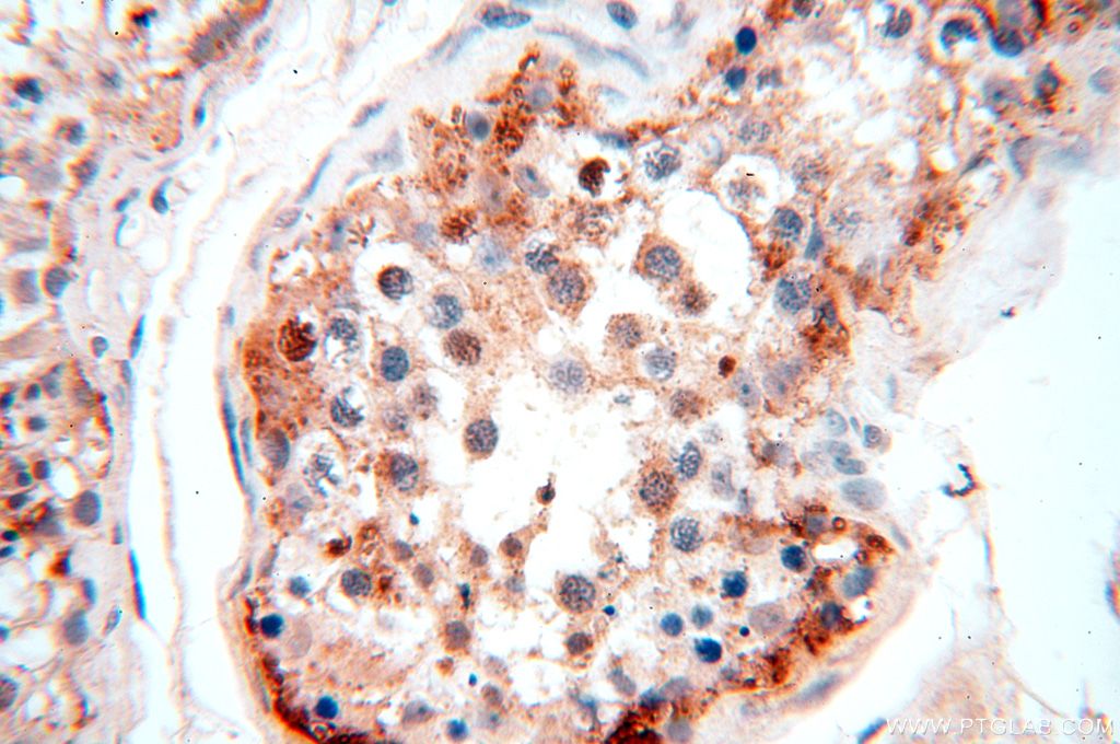 Immunohistochemistry (IHC) staining of human testis tissue using PGBD3 Polyclonal antibody (17639-1-AP)