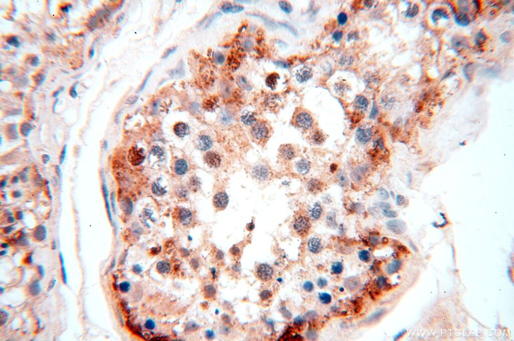 IHC staining of human testis using 17639-1-AP