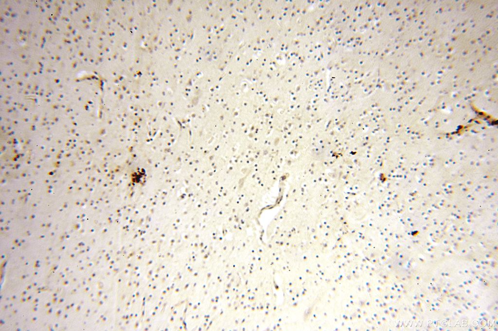 Immunohistochemistry (IHC) staining of human brain tissue using PGBD3 Polyclonal antibody (17639-1-AP)