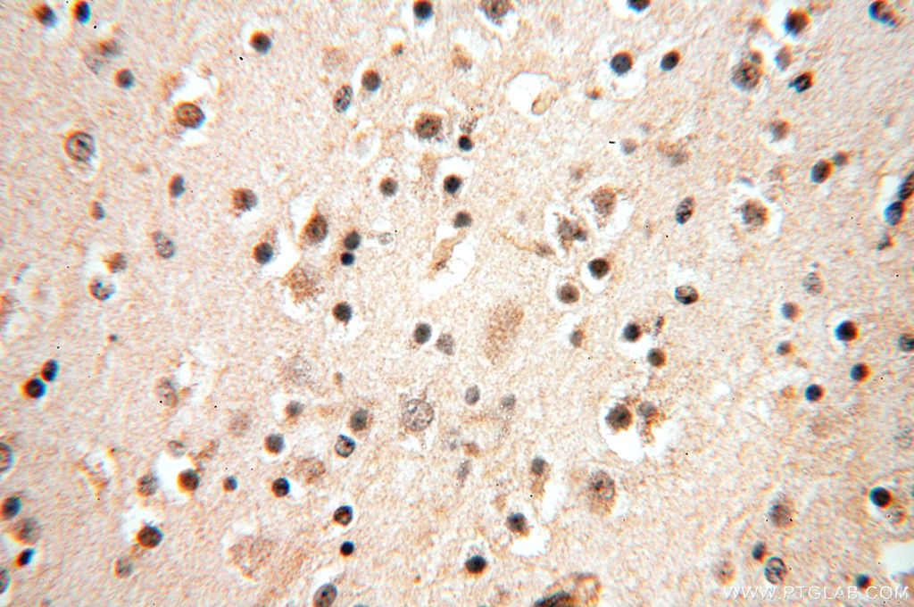 Immunohistochemistry (IHC) staining of human brain tissue using PGBD3 Polyclonal antibody (17639-1-AP)