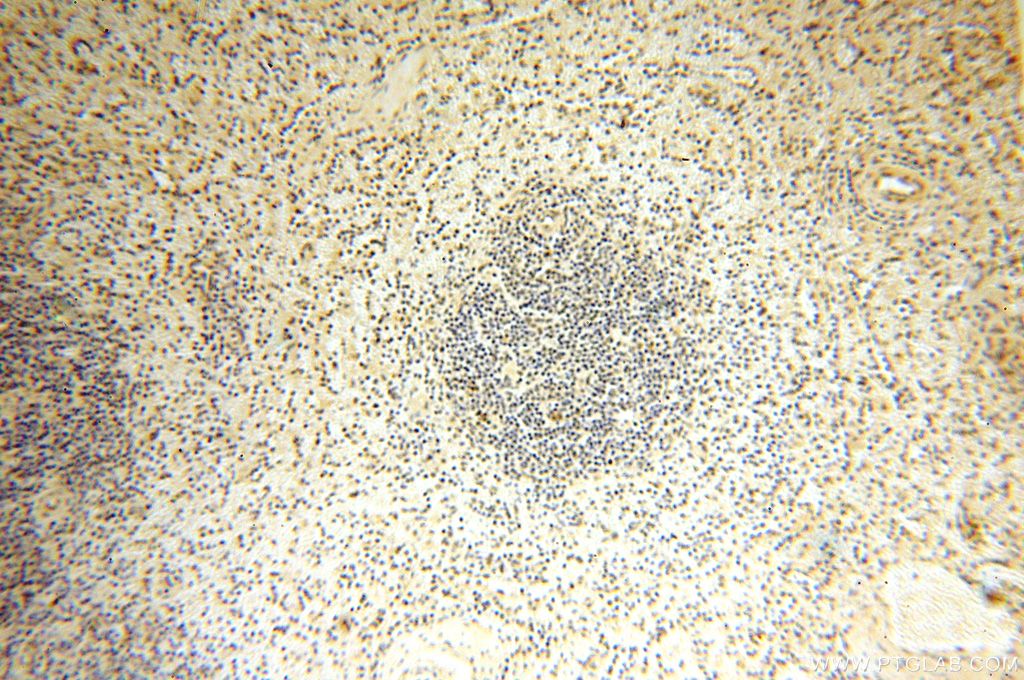 Immunohistochemistry (IHC) staining of human spleen tissue using PGBD3 Polyclonal antibody (17639-1-AP)