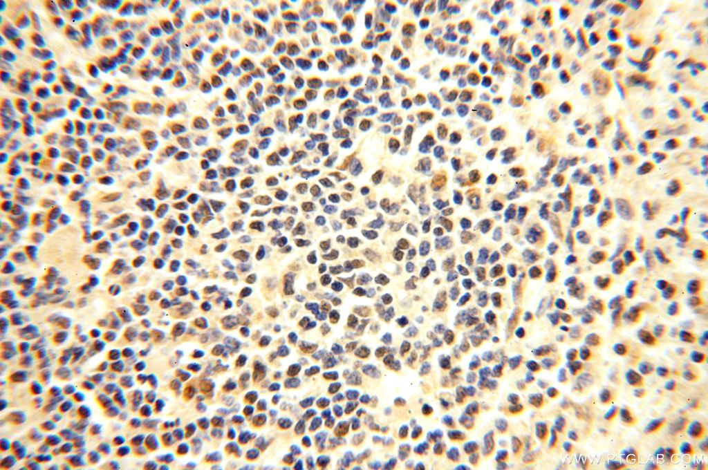 Immunohistochemistry (IHC) staining of human spleen tissue using PGBD3 Polyclonal antibody (17639-1-AP)