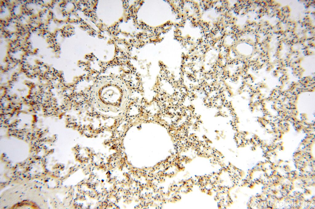 Immunohistochemistry (IHC) staining of human lung tissue using PGBD3 Polyclonal antibody (17639-1-AP)