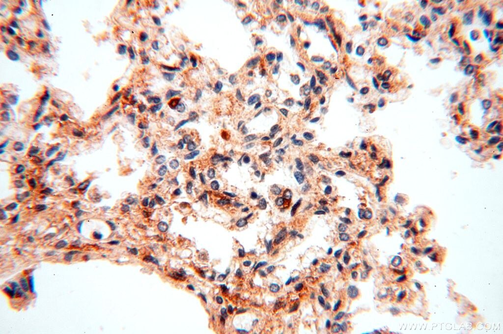 Immunohistochemistry (IHC) staining of human lung tissue using PGBD3 Polyclonal antibody (17639-1-AP)