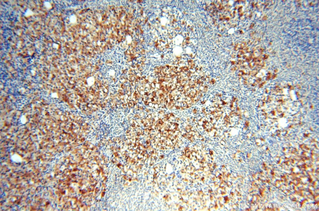 Immunohistochemistry (IHC) staining of human ovary tissue using PGBD3 Polyclonal antibody (17639-1-AP)