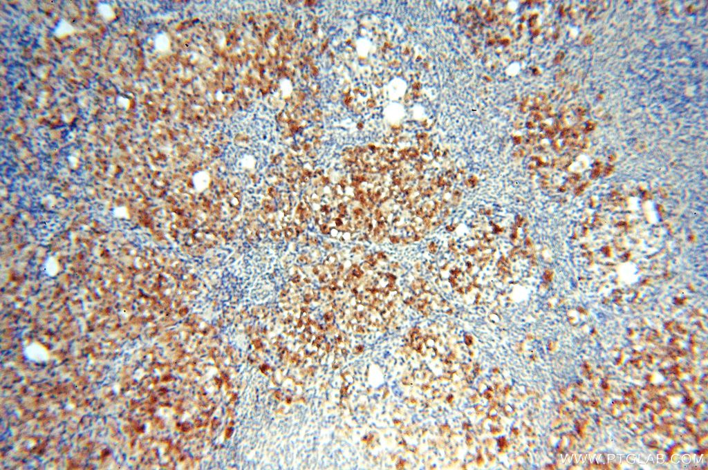 Immunohistochemistry (IHC) staining of human ovary tissue using PGBD3 Polyclonal antibody (17639-1-AP)