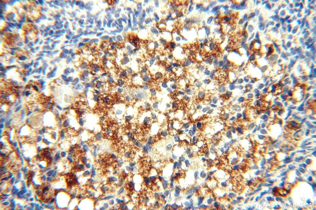 Immunohistochemistry (IHC) staining of human ovary tissue using PGBD3 Polyclonal antibody (17639-1-AP)