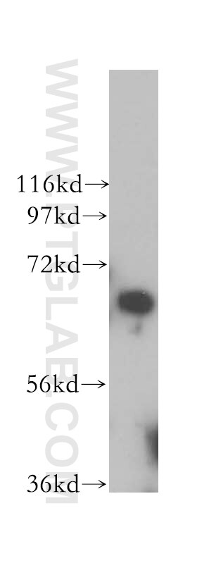 Western Blot (WB) analysis of HeLa cells using PGBD3 Polyclonal antibody (17639-1-AP)