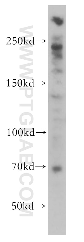 Western Blot (WB) analysis of HeLa cells using PGBD3 Polyclonal antibody (17639-1-AP)