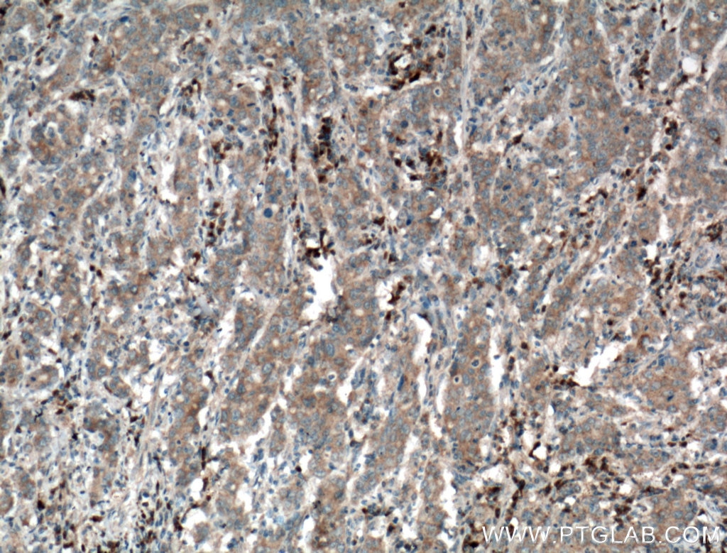 Pepsinogen II