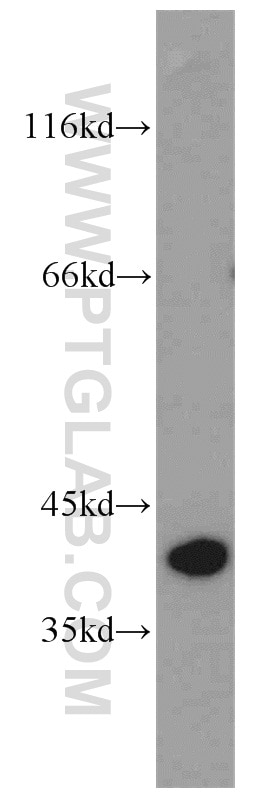 Western Blot (WB) analysis of human stomach tissue using Pepsinogen II Polyclonal antibody (16881-1-AP)