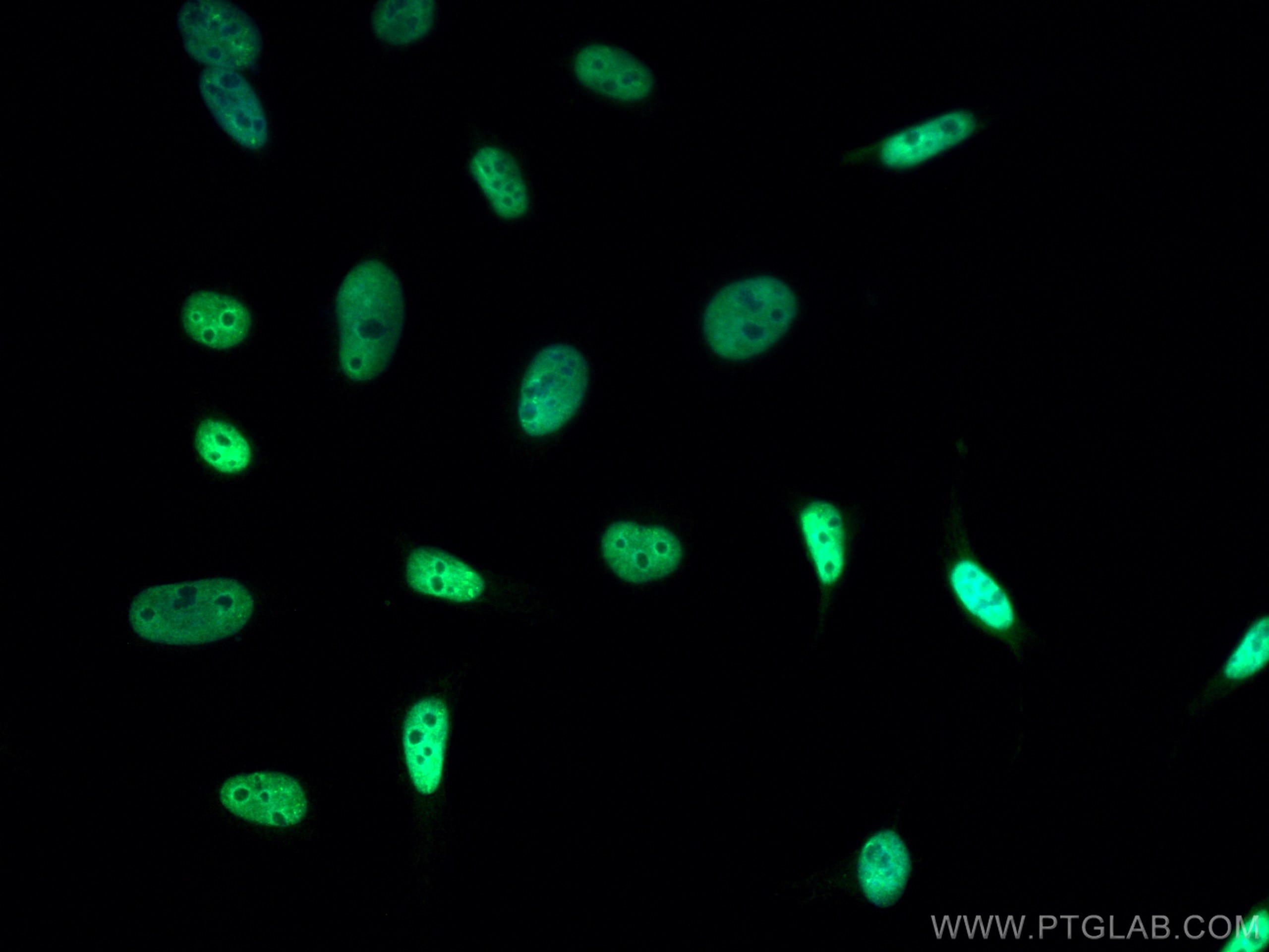Immunofluorescence (IF) / fluorescent staining of HeLa cells using CoraLite®488-conjugated PGC1a Monoclonal antibody (CL488-66369)
