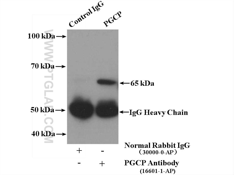 Immunoprecipitation (IP) experiment of mouse kidney tissue using PGCP Polyclonal antibody (16601-1-AP)