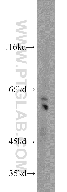 Western Blot (WB) analysis of mouse kidney tissue using PGCP Polyclonal antibody (16601-1-AP)