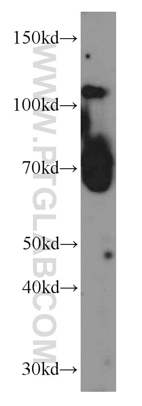 Western Blot (WB) analysis of human plasma using PGCP Polyclonal antibody (16601-1-AP)